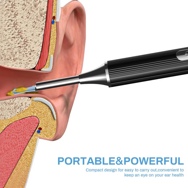 Ear Wax Removal Endoscope, 1080P HFD Visual Wireless Earwax Cleaner with 6 LED Lights, Waterproof Plastic Ear Camera Earpicks Compatible iPhone, iPad and Android